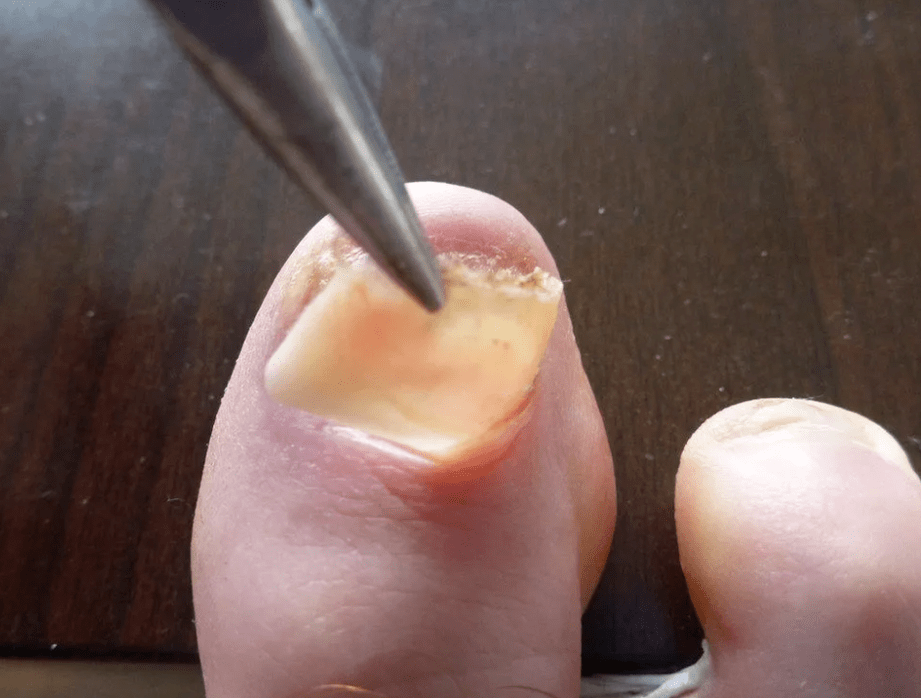 Απόσταση από το πιάτο