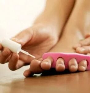 Χρήση του θεραπευτικού βερνικιού